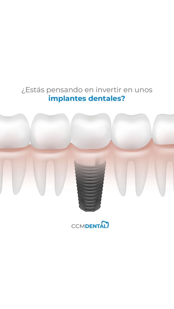 ImplantesDentales 1