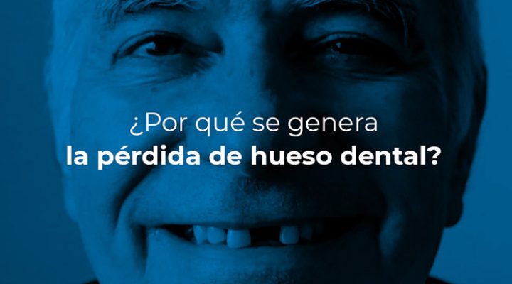 08-13