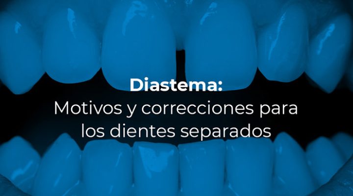 08-45