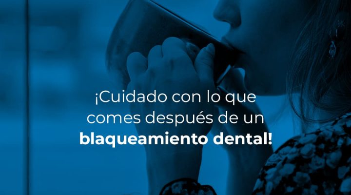 BlanqueamientoDentalComidas-1