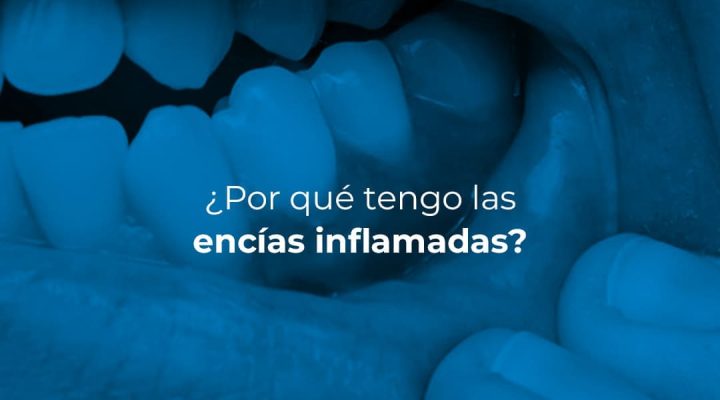 EnciasInflamadas