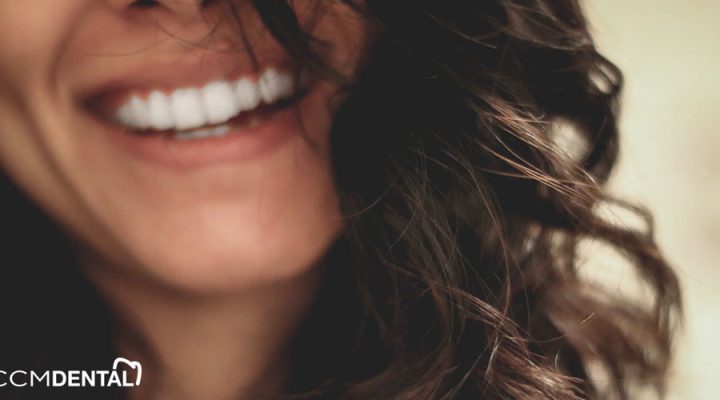 carillas-dentales-vs-coronas