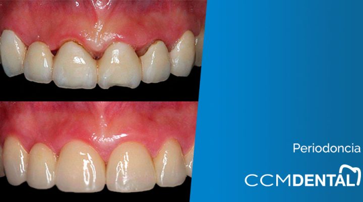 periodoncia
